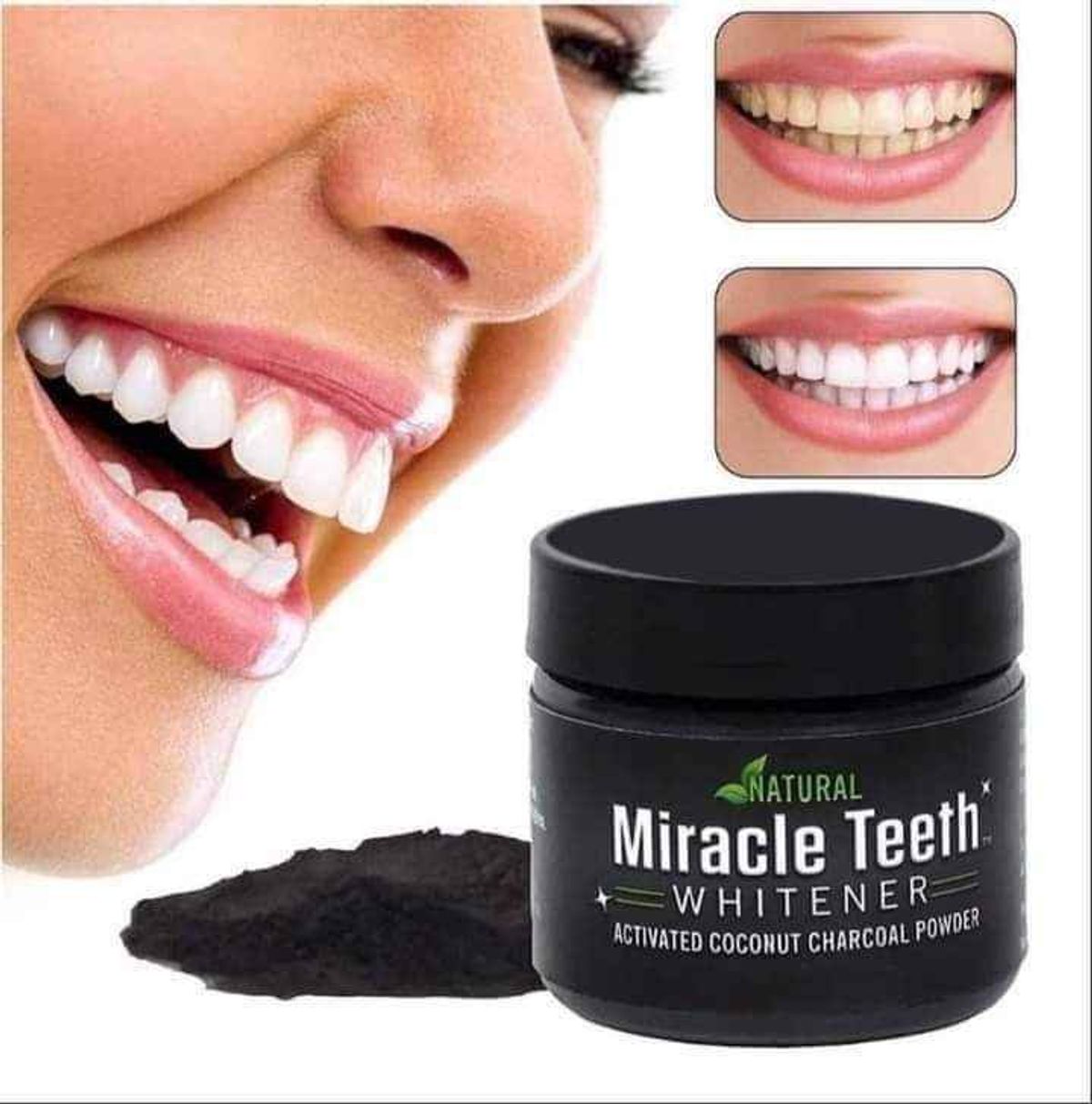Miracle Teeth Whitenerمبيض الأسنان